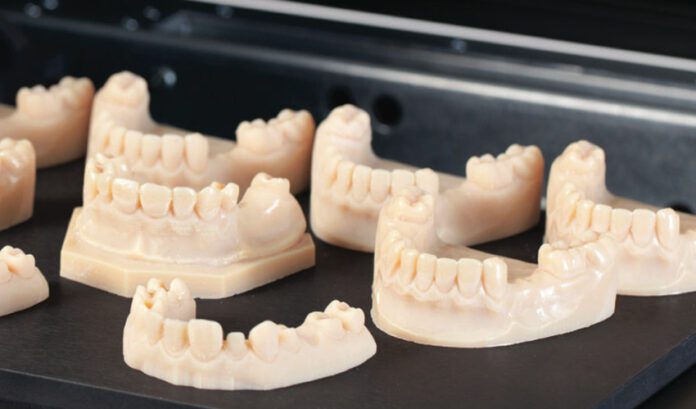 implantes dentales 3d