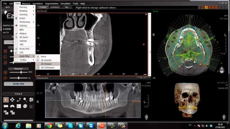 ¿Qué software se usa en Impresión 3D médica?